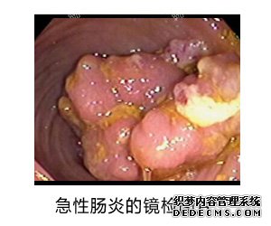 大连开发区肛肠医院